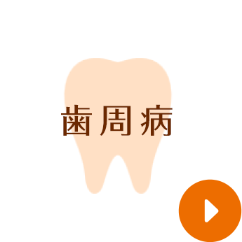 歯周病
